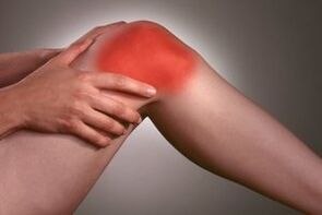 Pain in the knee joint due to osteoarthritis